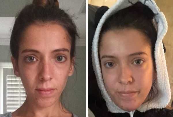 Как осанка влияет на лицо фото до и после