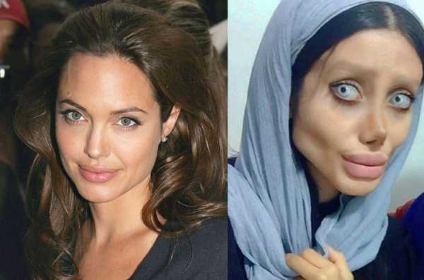 Джоли удалила молочные железы до и после фото